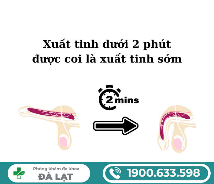 Hình ảnh minh họa
